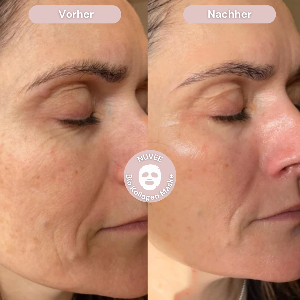 Bio Kollagenmaske