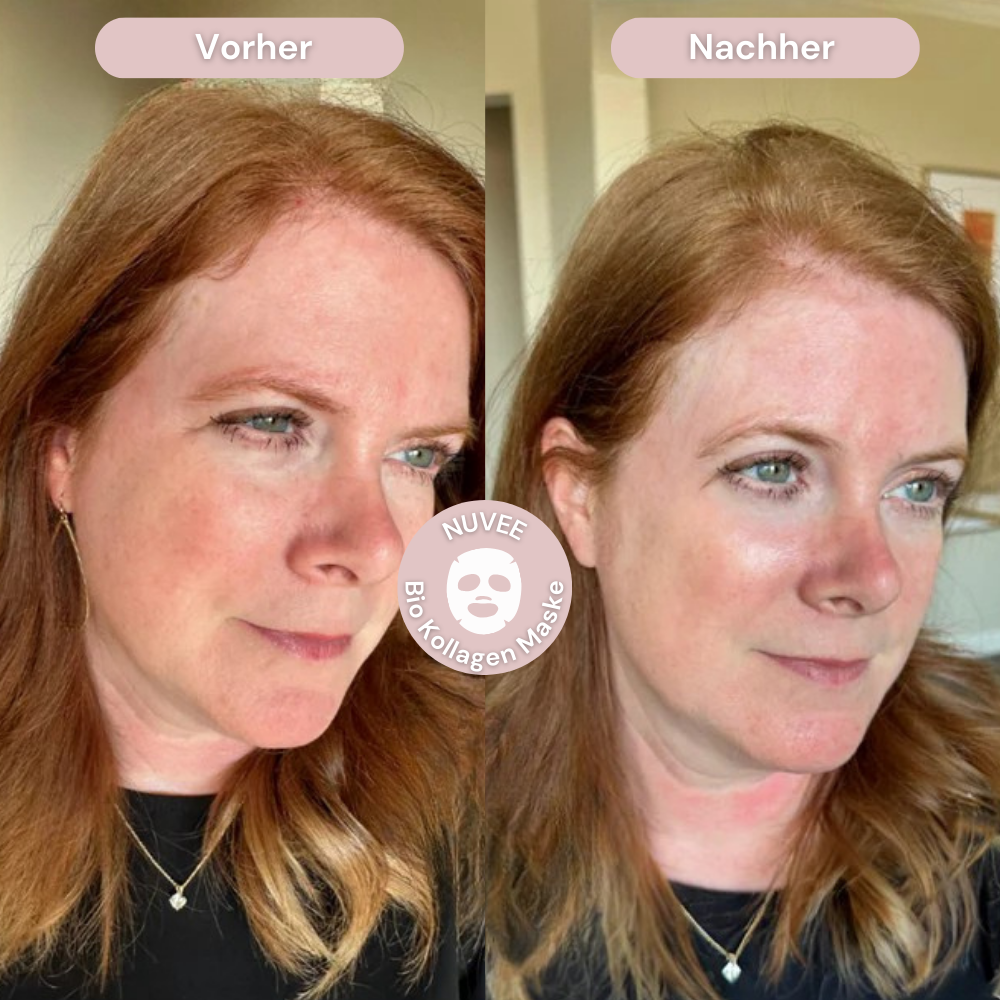 Bio Kollagenmaske