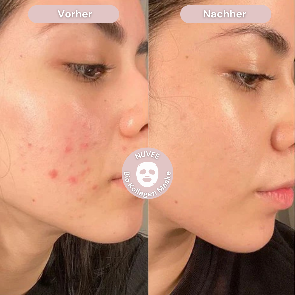 Bio Kollagenmaske